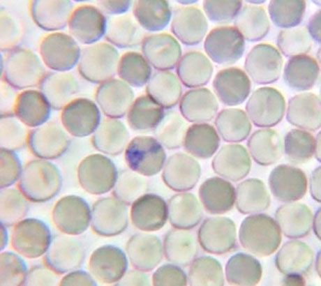 Reticulocyte (BCG stain)