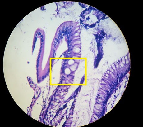 Colon: 400×