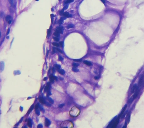 Colon: 1600× (extra enlargement with mobile zoom)