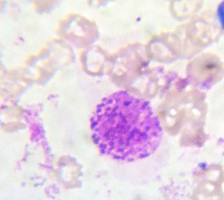 Basophil