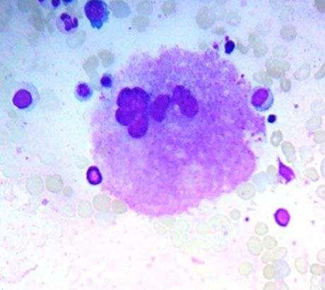 Megakaryocyte
