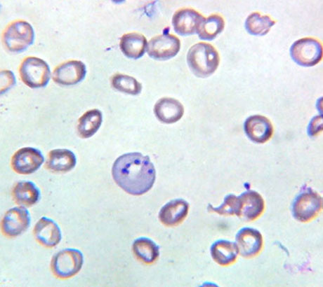 RBC inclusions