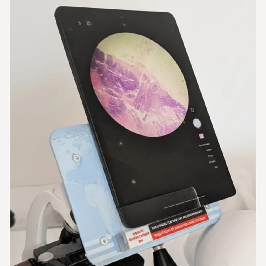 Tablet mounted on a microscope with Smart MicroVision NX